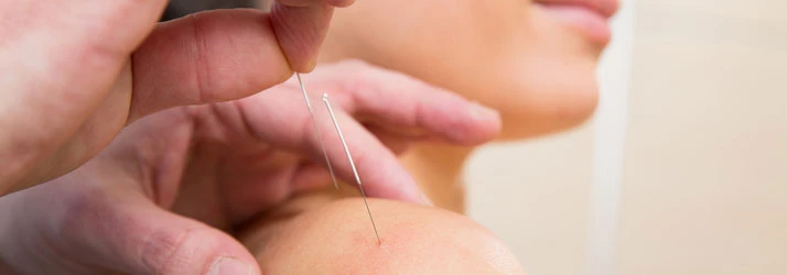 Chiropractic Ottawa ON Acupuncture