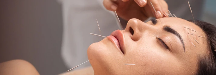 Chiropractic Ottawa ON Cosmetic Acupuncture
