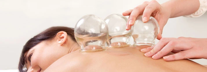 Chiropractic Ottawa ON Cupping Workshop