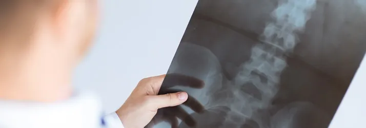 Chiropractic Ottawa ON spinal exam xray Chiropractic Ottawa ON spinal exam xray